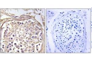 Immunohistochemistry analysis of paraffin-embedded human testis tissue, using CHST9 Antibody. (CHST9 anticorps  (AA 361-410))