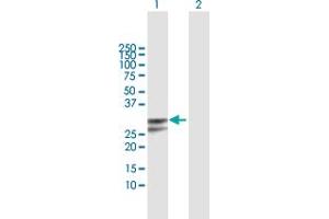 Western Blot analysis of PPP1R2P3 expression in transfected 293T cell line by PPP1R2P3 MaxPab polyclonal antibody. (PPP1R2P3 anticorps  (AA 1-205))