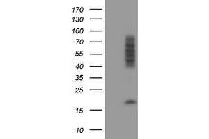 Western Blotting (WB) image for anti-CCR4-NOT Transcription Complex Subunit 4 (CNOT4) (AA 190-455) antibody (ABIN1491100) (CNOT4 anticorps  (AA 190-455))