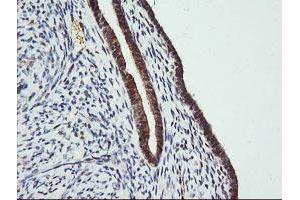 Image no. 6 for anti-tRNA Methyltransferase 2 Homolog A (TRMT2A) antibody (ABIN1501518) (TRMT2A anticorps)