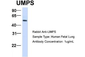 Host:  Rabbit  Target Name:  UMPS  Sample Type:  Human Fetal Lung  Antibody Dilution:  1. (UMPS anticorps  (C-Term))