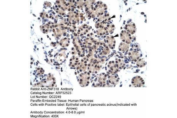 ZNF318 anticorps  (N-Term)