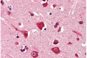 Human Brain, Cortex (formalin-fixed, paraffin-embedded) stained with PDPN antibody ABIN364350 at 5 ug/ml followed by biotinylated anti-mouse IgG secondary antibody ABIN481714, alkaline phosphatase-streptavidin and chromogen. (Podoplanin anticorps  (AA 1-206))