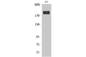 Western Blotting (WB) image for anti-Insulin Receptor Substrate 1 (IRS1) (pSer307) antibody (ABIN3172917) (IRS1 anticorps  (pSer307))