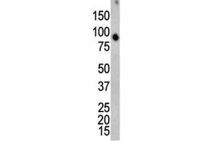 Western blot analysis of ERK4 antibody and mouse brain tissue lysate. (MAPK7 anticorps  (AA 527-557))