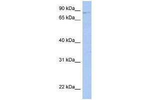 LRRC33 antibody used at 1 ug/ml to detect target protein. (LRRC33 anticorps  (Middle Region))