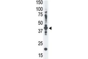 Western Blotting (WB) image for anti-Melanoma Antigen Family A, 4 (MAGEA4) antibody (ABIN3002532) (MAGEA4 anticorps)