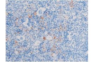 ABIN6267553 at 1/200 staining Mouse spleen tissue sections by IHC-P. (LIMK-1/2 (pThr505), (pThr508) anticorps)
