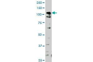 HIPK1 monoclonal antibody (M04), clone 1F2 Western Blot analysis of HIPK1 expression in HeLa . (HIPK1 anticorps  (AA 330-430))