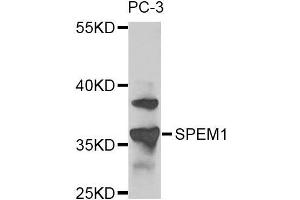 Western blot analysis of extracts of PC-3 cells, using SPEM1 antibody. (SPEM1 anticorps)