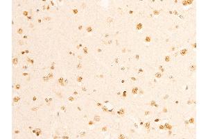 Immunohistochemistry (IHC) image for anti-Nuclear Factor-kB p65 (NFkBP65) (pSer536) antibody (ABIN6255402)