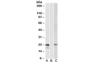 Western blot testing of HEK293 lysate overexpressing human CST8-MYC probed with Cystatin 8 antibody [0. (CST8 anticorps)