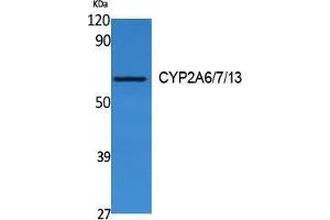 Western Blotting (WB) image for anti-CYP2A6/7/13 (Internal Region) antibody (ABIN3180978) (CYP2A6/7/13 (Internal Region) anticorps)