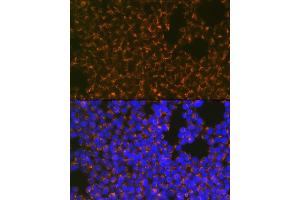 Immunofluorescence analysis of Jurkat cells using CCR8 Rabbit mAb (ABIN1683150, ABIN3018779, ABIN3018780 and ABIN7101661) at dilution of 1:100 (40x lens). (CCR8 anticorps)
