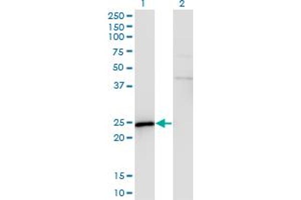 SPA17 anticorps  (AA 51-149)