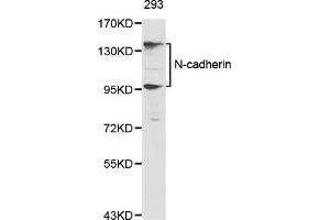 Western Blotting (WB) image for anti-Cadherin 2 (CDH2) (AA 450-550) antibody (ABIN5663657) (N-Cadherin anticorps  (AA 450-550))
