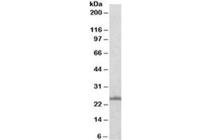 Western blot testing of A431 with RAN antibody at 0. (RAN anticorps)