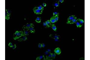 Immunofluorescence staining of HepG2 cells with ABIN7162435 at 1:100, counter-stained with DAPI. (P-Selectin anticorps  (AA 543-767))
