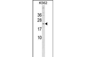CRYBB3 Antibody (C-term) (ABIN1536797 and ABIN2849948) western blot analysis in K562 cell line lysates (35 μg/lane). (CRYBB3 anticorps  (C-Term))