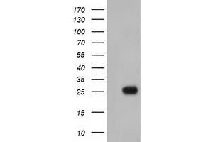 Western Blotting (WB) image for anti-MOB Kinase Activator 3B (MOB3B) antibody (ABIN1499534) (MOBKL2B anticorps)