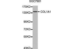 Western blot analysis of extracts of SGC7901 cell line, using COL1A1 antibody. (COL1A1 anticorps)