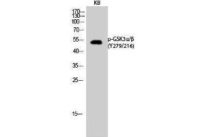 Western Blotting (WB) image for anti-Glycogen Synthase Kinase 3 alpha/beta (GSK3a/b) (pTyr216), (pTyr279) antibody (ABIN6288285) (GSK3 alpha/beta anticorps  (pTyr216, pTyr279))