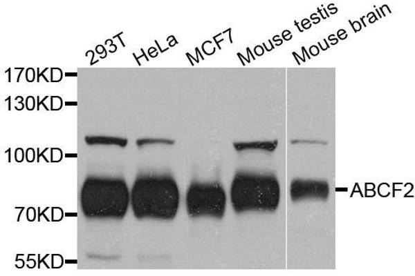 ABCF2 anticorps  (AA 1-250)