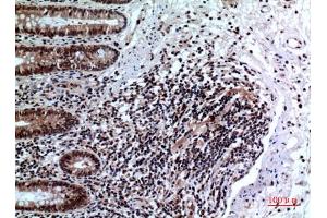 Immunohistochemical analysis of paraffin-embedded human-colon, antibody was diluted at 1:100. (FOXP3 anticorps  (C-Term))