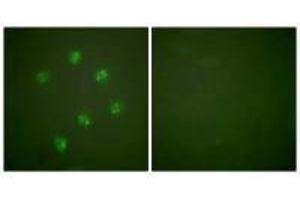 Immunofluorescence analysis of COS7 cells, using Ki67antibody. (Ki-67 anticorps  (C-Term))