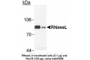 Image no. 2 for anti-Ribonuclease L (2',5'-Oligoisoadenylate Synthetase-Dependent) (RNASEL) antibody (ABIN363220) (RNASEL anticorps)