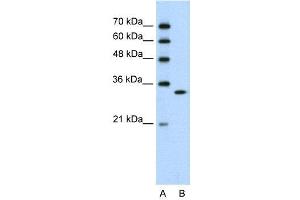 WB Suggested Anti-RNASEH2A  Antibody Titration: 0. (RNASEH2A anticorps  (C-Term))