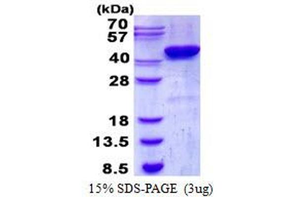 CSNK2A2 Protein (His tag)