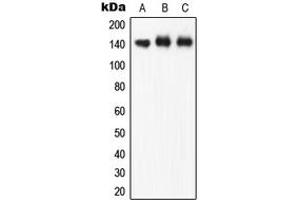 Western blot analysis of eNOS (pS1177) expression in A549 (A), HuvEc (B), rat brain (C) whole cell lysates. (ENOS anticorps  (C-Term, pSer1177))