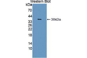 Western blot analysis of the recombinant protein. (HSD17B12 anticorps  (AA 1-312))