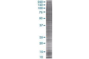 CXCL5 transfected lysate (CXCL5 293T Cell Transient Overexpression Lysate(Denatured))