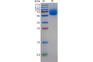 Human T Protein, His Tag on SDS-PAGE under reducing condition. (TYRO3 Protein (AA 41-428) (His tag))