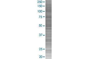 PIAS2 transfected lysate. (PIAS2 293T Cell Transient Overexpression Lysate(Denatured))