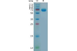 Mouse B7-H3 Protein, hFc Tag on SDS-PAGE under reducing condition. (CD276 Protein (CD276) (AA 29-244) (Fc Tag))