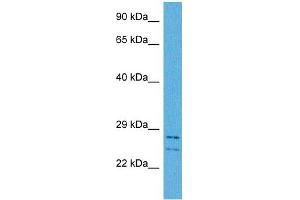 Host:  Rabbit  Target Name:  CSRP3  Sample Tissue:  Human HCT116 Whole Cell  Antibody Dilution:  1ug/ml (CSRP3 anticorps  (Middle Region))