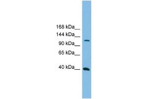 WB Suggested Anti-MAP3K14  Antibody Titration: 0. (MAP3K14 anticorps  (N-Term))
