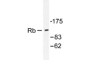 Image no. 1 for anti-Retinoblastoma 1 (RB1) antibody (ABIN271803) (Retinoblastoma 1 anticorps)
