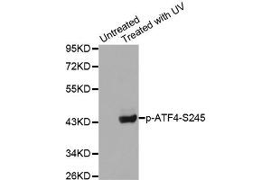 Western Blotting (WB) image for anti-Activating Transcription Factor 4 (Tax-Responsive Enhancer Element B67) (ATF4) (pSer245) antibody (ABIN1869995) (ATF4 anticorps  (pSer245))