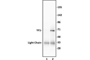 YY1 antibody (pAb) tested by Western blot. (YY1 anticorps)