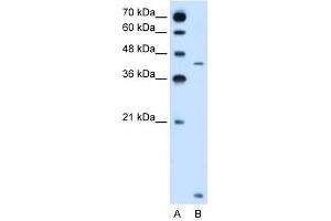 SLC46A3 antibody used at 2. (SLC46A3 anticorps  (N-Term))