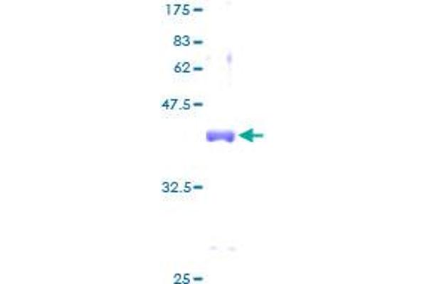 SNRPD2 Protein (AA 1-118) (GST tag)