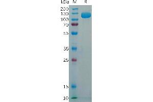 CD56 Protein (AA 220-718) (His tag)