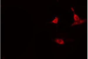 ABIN6274112 staining HeLa cells by IF/ICC. (BUB1B anticorps  (C-Term))