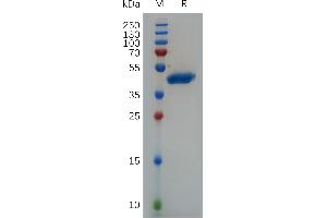 Human VEGFA Protein, hFc Tag on SDS-PAGE under reducing conditions. (VEGFA Protein (AA 27-147) (Fc Tag))