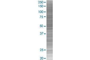 TNXB transfected lysate. (TNXB 293T Cell Transient Overexpression Lysate(Denatured))