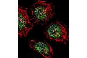 Fluorescent confocal image of Hela cell stained with CAF-1 Antibody (N-term). (CNOT8 anticorps  (N-Term))